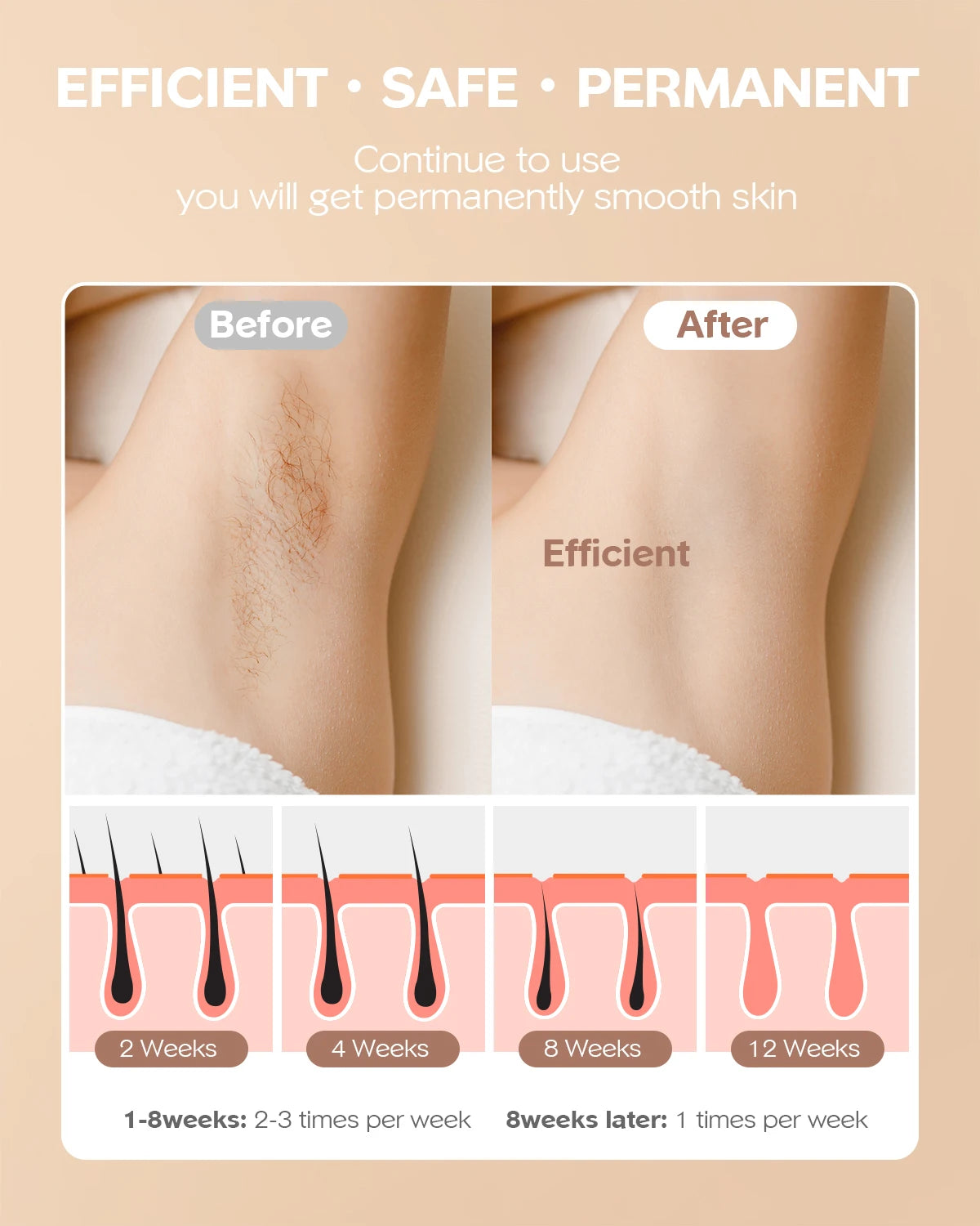 Laser Hair Removal Device – Painless IPL Hair Removal at Home | 999,000 Flashes